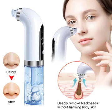 USB Blackhead Meter 400mAh Electric Vacuum Blackhead Acne Pore Cleaner Water Cycle Skin Deep Cleaning Beauty Care Tools