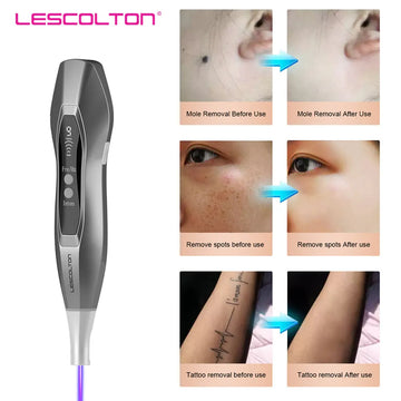 Lescolton New Laser Picosecond Pen Freckle Tattoo Removal Laser Mole Dark Spot Eyebrow Pigment Remover Acne Remove Beauty Care